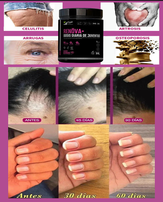 COLÁGENO RENÖVA➕️ DOSIS DIARIA DE JUVENTUD